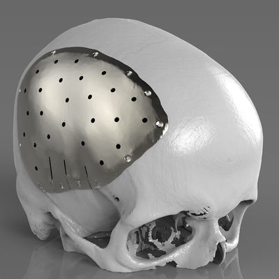 3D-Druck von Metall, Edelstahl S136 und Aluminium Alsi10mg für Konzeptmodelle